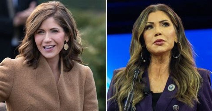 Ana Jalandoni Before and After Surgery Pictures, Actress Sustained Injuries After Kit Thompson Abuse
