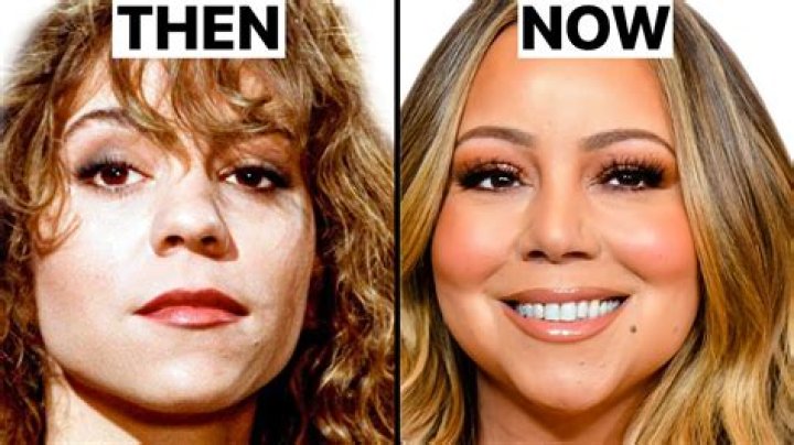 Has Shawn Johnson Gotten Any Plastic Surgery Recently? Here Is Why She Looks So Different Now