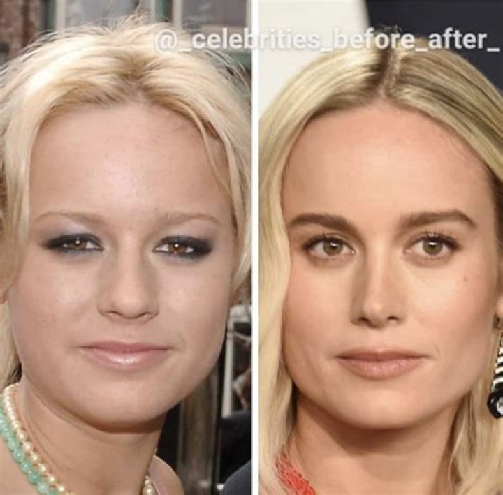 Sarah Huckabee Sanders Plastic Surgery | Before And After Photos